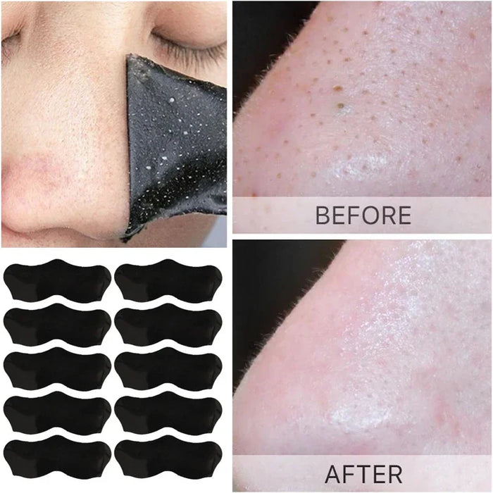 Blackhead Removal Patch