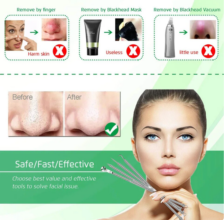 🌲Early Christmas Sale - SAVE OFF 60%🎁 Tool Blackhead Remover  Extractor