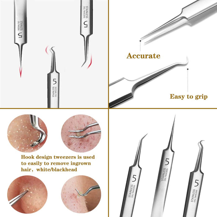 Precision Blackhead Tweezers Set