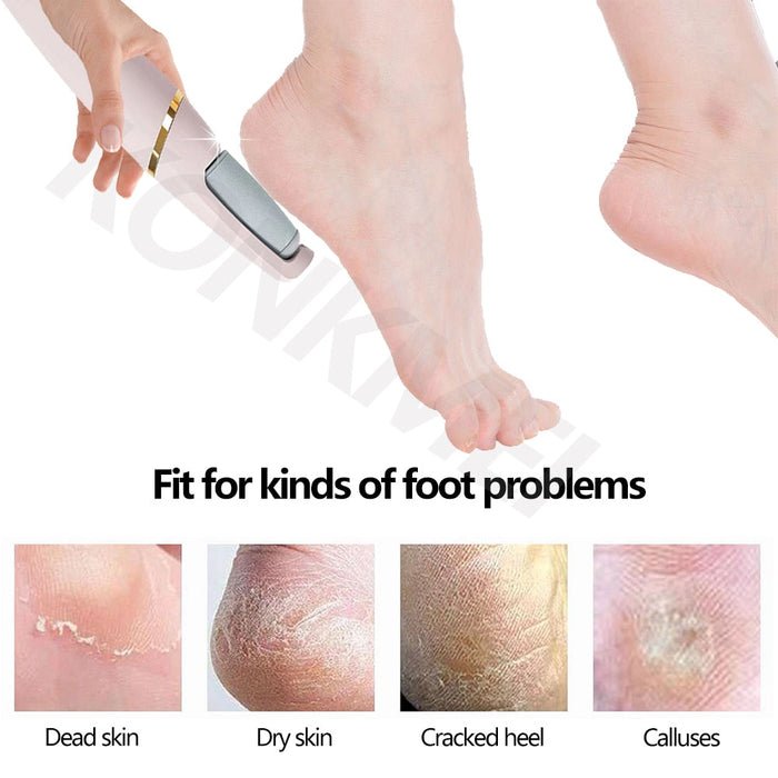 Machine Heel Exfoliator